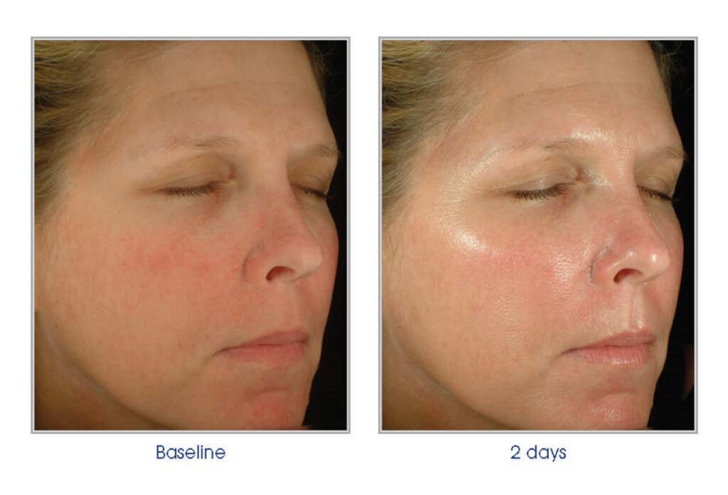 Winter skin made radiant