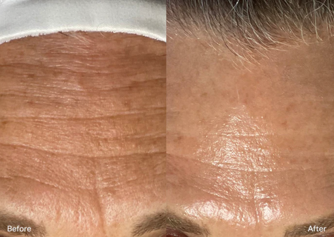 Image Hydrafacial B&A 4